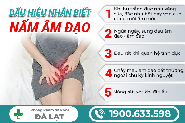 Hình ảnh minh họa